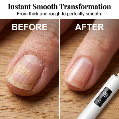 🥳2026 HOT SALE🥳💞30K+ SOLD!💅✨Professional Electric Nail Polisher – Smooths thick nails, 99-speed display. Multiple heads for shaping & buffing. Salon at home! 🌟💎