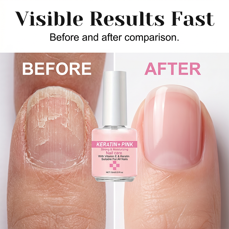 💅 2026 Sale — Over 47,000 Sold!✨ Keratin Nail Strengthener – Repairs Rough Surfaces & Glossy Finish 🌟